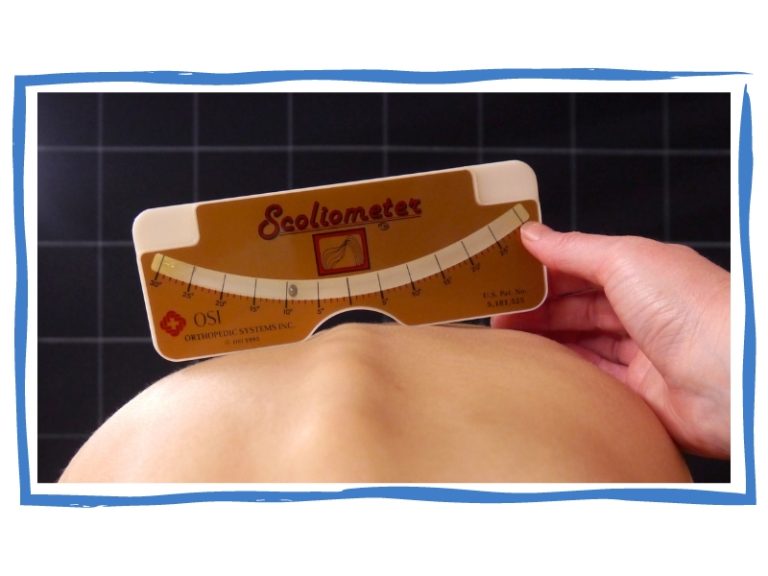 Bildbeschreibung: Das Bild zeigt ein eine spezielle Wasserwaage (Skoliometer) auf dem verdrehten Rücken eines Patienten.